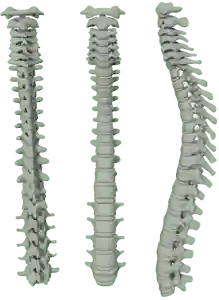 Spine Image