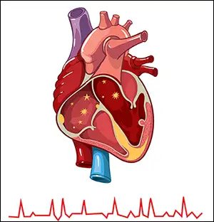 heart image with afib