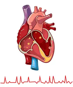 Understanding Atrial Fibrillation: Causes, Symptoms, and Treatment Options