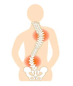 A Guide to Scoliosis Treatment Options and Surgical Procedures